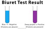 Biuret Test: Definition, Theory, Procedure, and Results