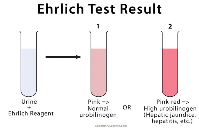 Ehrlich Reagent: Definition, Preparation, And Result